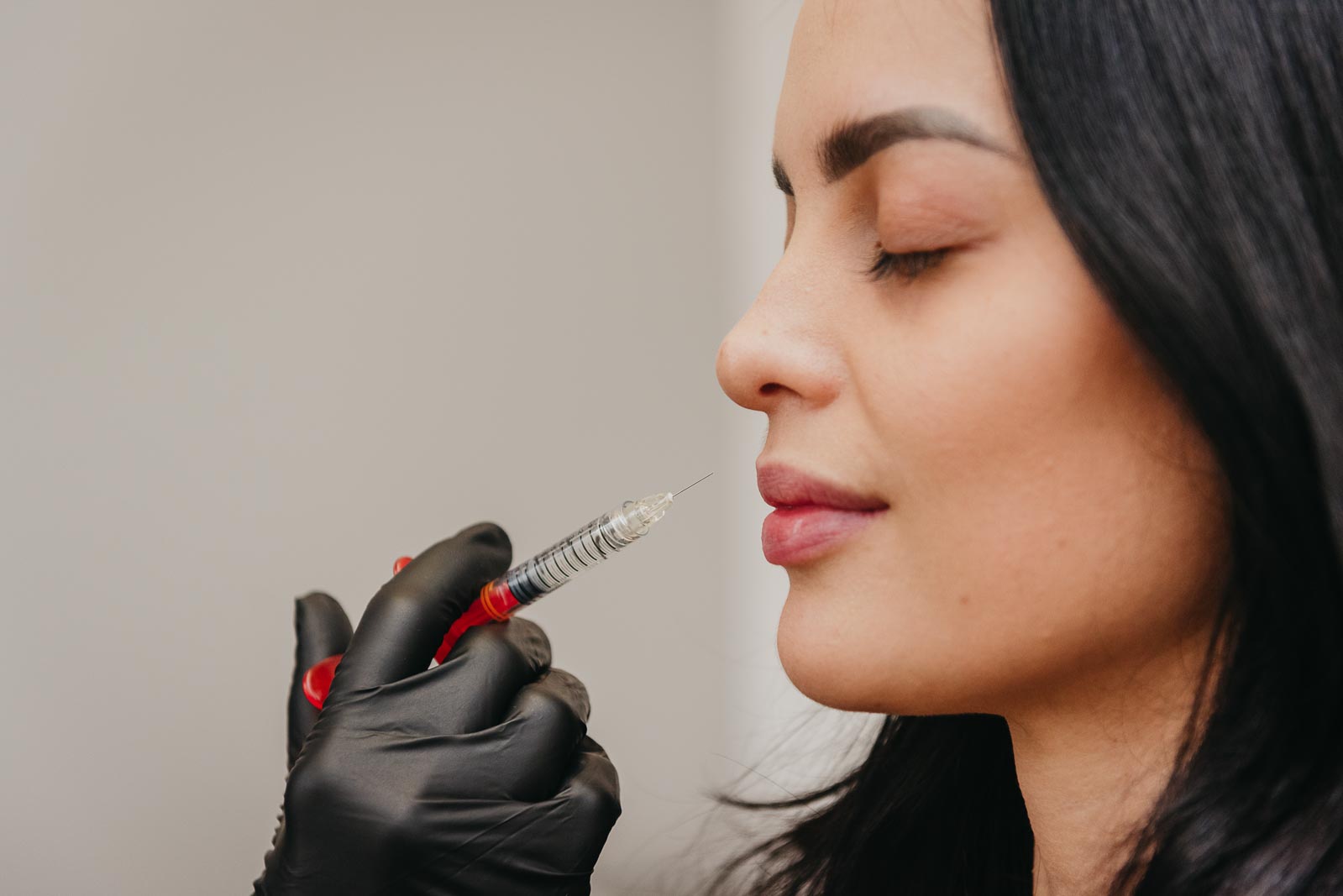 Lip Filler